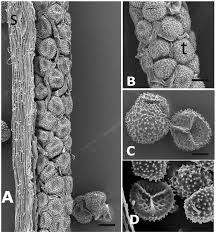 Attēlu rezultāti vaicājumam “Stemonitopsis aequalis var. microspora spores”