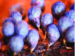 Attēlu rezultāti vaicājumam “Badhamia utricularis spores”