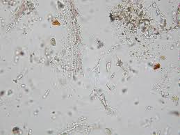 Attēlu rezultāti vaicājumam “Setaria viridis leaf”