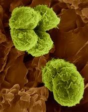 Attēlu rezultāti vaicājumam “Pleurococcus vulgaris”