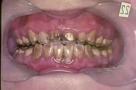http://t0.gstatic.com/images?q=tbn:ANd9GcQlna-NFrQNHTlAxGl9NHqLRtm2KHFJ-yO7hcElYdgPbRH4QpU&t=1&usg=__g0b4otvi-jgoTiSsQjQ3kpwHkik=