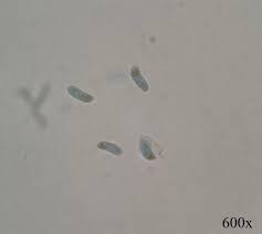 Attēlu rezultāti vaicājumam “Dacrymyces chrysospermus spores”