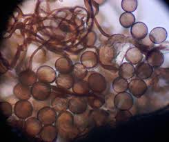 Attēlu rezultāti vaicājumam “Comatricha alta stalked”