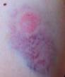 http://miniature-art.tripod.com/sitebuildercontent/sitebuilderpictures/abrams-bruising.jpg