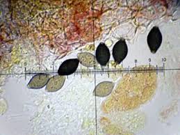 Attēlu rezultāti vaicājumam “Melanospora lagenaria”