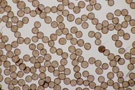 Attēlu rezultāti vaicājumam “Craterium aureonucleatum spores”
