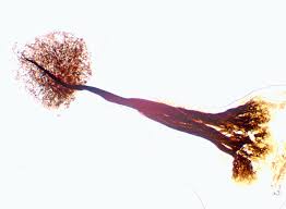 Attēlu rezultāti vaicājumam “Comatricha laxa spores”