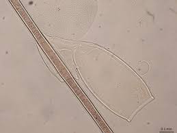 Attēlu rezultāti vaicājumam “Licea pygmaea sessile”