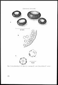 Attēlu rezultāti vaicājumam “Stemonitopsis subcaespitosa spores”