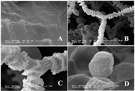 Attēlu rezultāti vaicājumam “Arcyria helvetica spores”