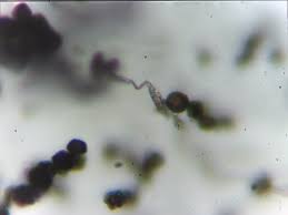 Attēlu rezultāti vaicājumam “Diderma subincarnatum spores”