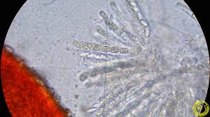 Attēlu rezultāti vaicājumam “Nectria episphaeria”