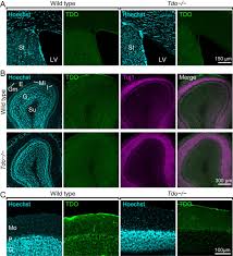 Attēlu rezultāti vaicājumam “Dianema depressum macro”