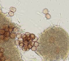 Attēlu rezultāti vaicājumam “Craterium aureum spores”