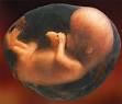 250px-Fetus_amniotic_sac.jpg