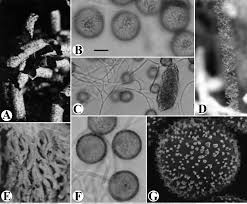 Attēlu rezultāti vaicājumam “Craterium leucocephalum var. scyphoides”