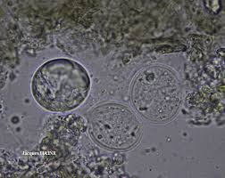 Attēlu rezultāti vaicājumam “Trichia contorta spores”