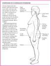 Cushing's syndrome cushings-syndrome – Find Me A Cure