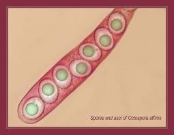 Attēlu rezultāti vaicājumam “Arcyria affinis young”