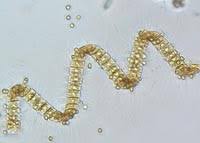 Attēlu rezultāti vaicājumam “Diachea sp.”