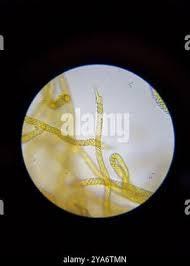 Attēlu rezultāti vaicājumam “Oligonema favogineum”