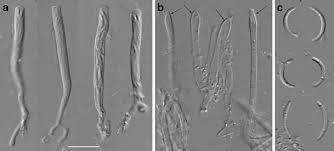 Attēlu rezultāti vaicājumam “Orbilia sp.”