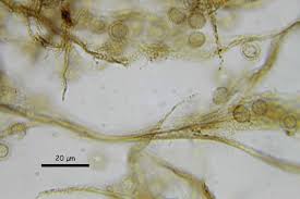Attēlu rezultāti vaicājumam “Reticularia jurana”