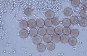 Attēlu rezultāti vaicājumam “Craterium minutum stalked”