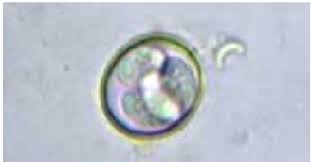 Картинки по запросу ...ЃРёРЅС‚РµР·Р°С‚РѕСЂ