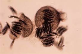 Attēlu rezultāti vaicājumam “Didymium annulisporum sessile”