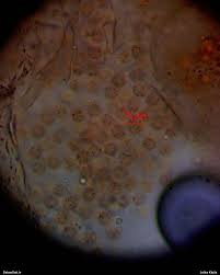 Attēlu rezultāti vaicājumam “Lycogala paraconfusum macro”