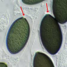 Attēlu rezultāti vaicājumam “Sordaria fimicola”