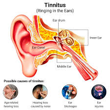 Image result for inthe.es