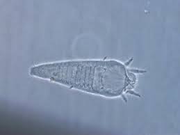 Attēlu rezultāti vaicājumam “Eriophyes padi”