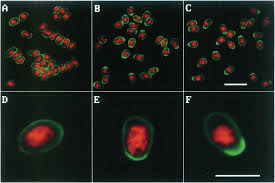Attēlu rezultāti vaicājumam “Tranzschelia pruni-spinosae spores”