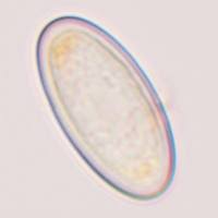 Attēlu rezultāti vaicājumam “Cheilymenia stercorea”