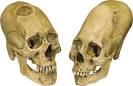 head flattening: Peruvian elongated skulls,c. 1000 bc ...