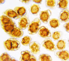 Attēlu rezultāti vaicājumam “Urocystis anemones spores”