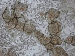 Attēlu rezultāti vaicājumam “Lycogala succineum”