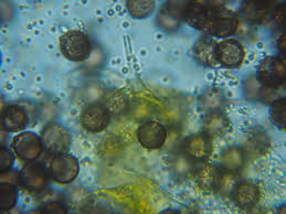 Attēlu rezultāti vaicājumam “Didymium xanthopus spores”