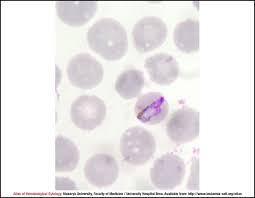 Attēlu rezultāti vaicājumam “Diderma radiatum plasmodium”