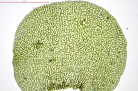 Attēlu rezultāti vaicājumam “Nardia scalaris cells”