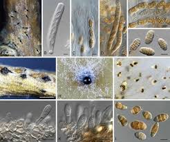 Attēlu rezultāti vaicājumam “Diderma radiatum spores”