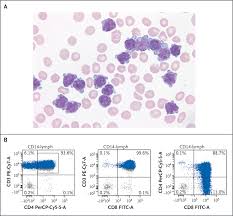 Attēlu rezultāti vaicājumam “Pseudobryum cinclidioides cells”