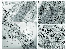 Image result for Vazella pourtalesii