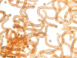 Attēlu rezultāti vaicājumam “Arcyria major”