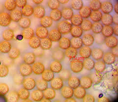 Attēlu rezultāti vaicājumam “Stemonitopsis hyperopta var. landewaldii young”