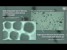Attēlu rezultāti vaicājumam “Enteridium variabile spores”