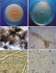 Attēlu rezultāti vaicājumam “Badhamia affinis var. microspora macro”
