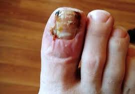 Image result for Amazing Feet Rc, Kidderminster